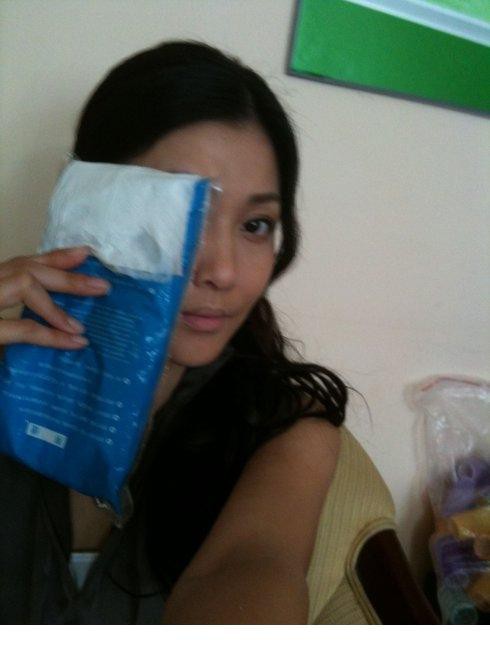 李彩桦被爆疑整容 生活素颜照惊人对比[8]